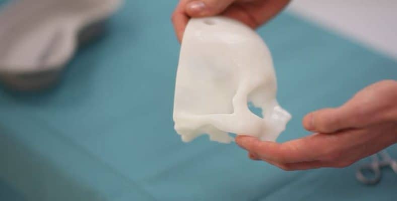 3D Printer for Medical Anatomy